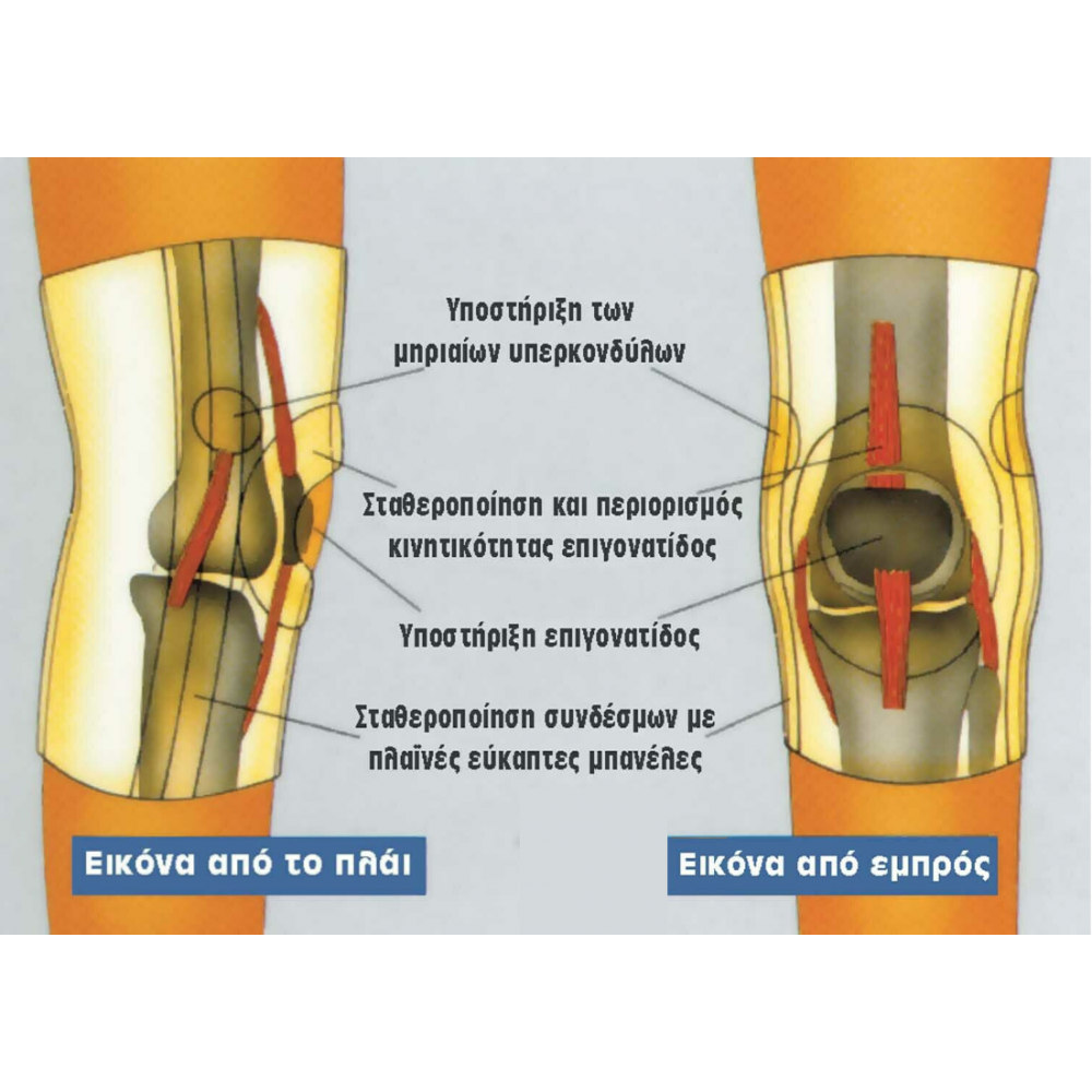 Ελαστική Επιγονατίδα με Επίθεμα Σιλικόνης & Πλάγιες Εύκαμπτες Μπανέλες "Genulastik" 