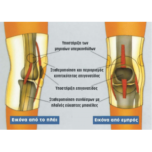 Ελαστική Επιγονατίδα με Επίθεμα Σιλικόνης & Πλάγιες Εύκαμπτες Μπανέλες "Genulastik" 